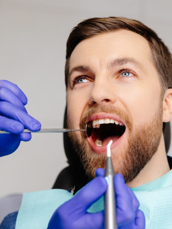 Man having teeth examined at dentists. Overview of dental caries prevention.