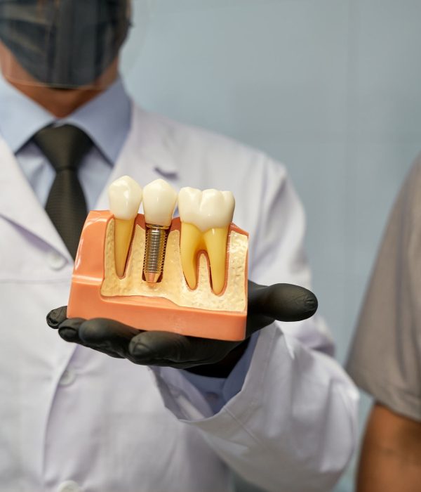 Cropped photo of doctors in face masks holding enlarged model of tooth implant and showing it to camera